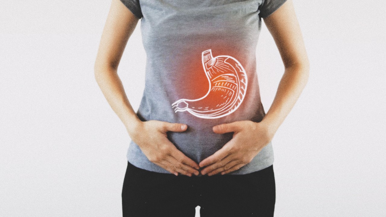 Cirugía gástrica por cáncer de estómago, gastrectomía oncológica