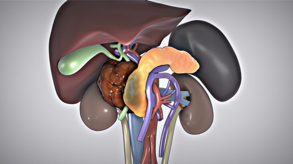 Cirugía de Whipple por cáncer de páncreas, valoración quirúrgica oncológica